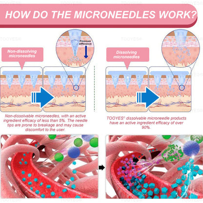 TOOYES®Only 5 boxes left! We're offering you an additional 30% discount! Get yourself in shape and healthy. Miss out now, and you won't have another chance until next year.