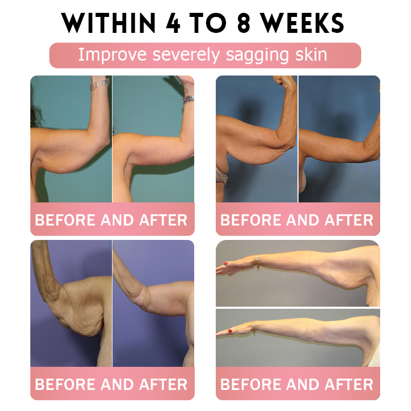 TOOYES®Only 5 boxes left! We're offering you an additional 30% discount! Get yourself in shape and healthy. Miss out now, and you won't have another chance until next year.