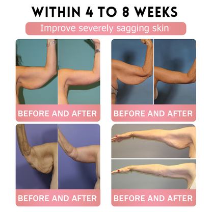 TOOYES®Only 5 boxes left! We're offering you an additional 30% discount! Get yourself in shape and healthy. Miss out now, and you won't have another chance until next year.